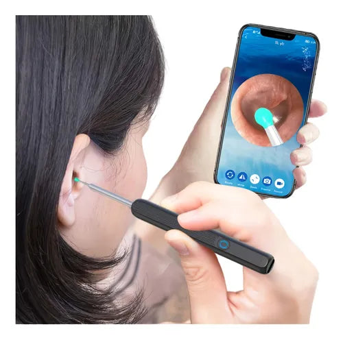 ✨Limpiador auditivo Smart con Camara🎥 - Otoscopio Premium💫
