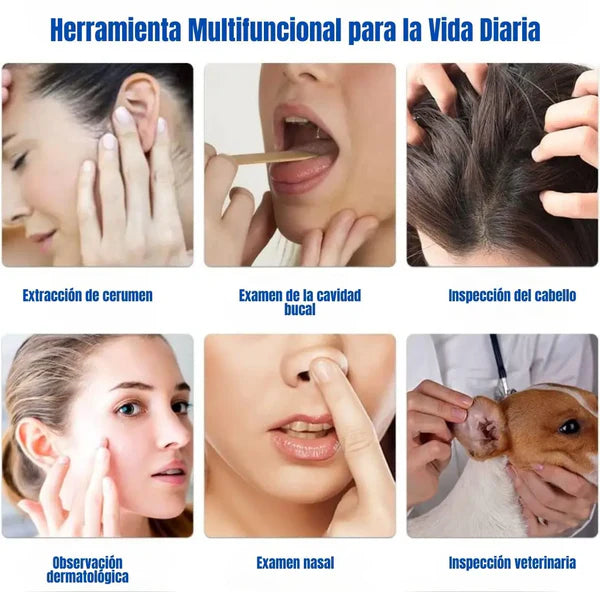 ✨Limpiador auditivo Smart con Camara🎥 - Otoscopio Premium💫